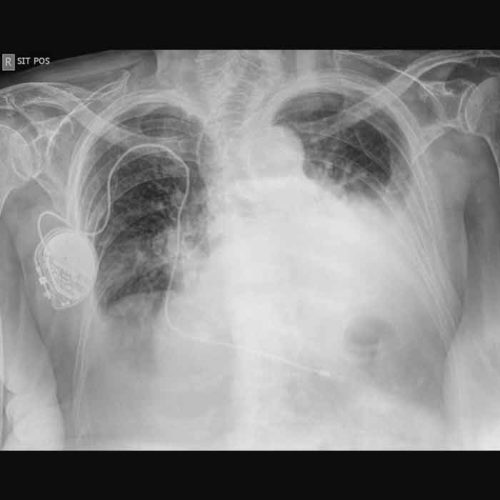 nosileiatora-radiography-3