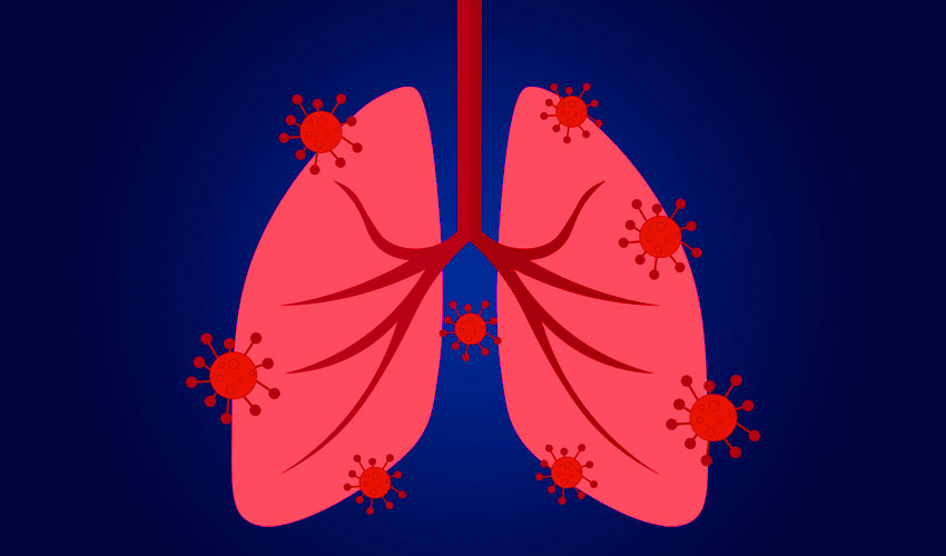 Πνευμονία: Μετάδοση, Συμπτώματα, Διάγνωση και Θεραπεία