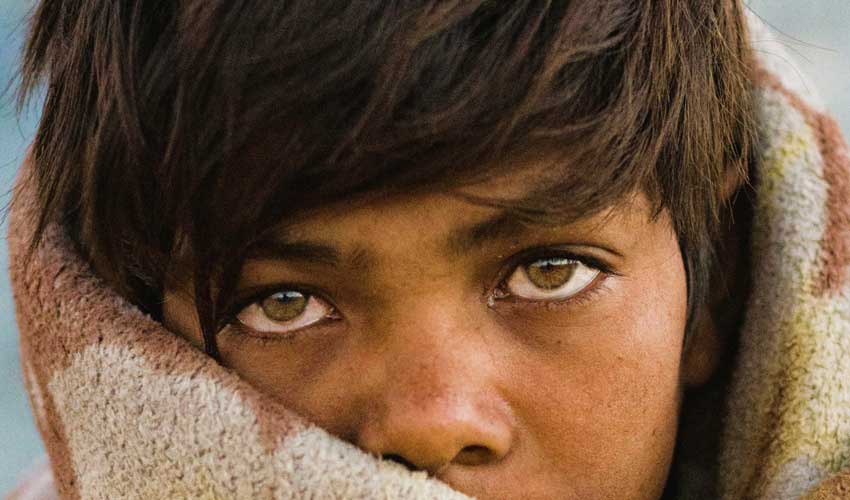 Ίκτερος: Είδη, Αίτια, Συμπτώματα και Θεραπεία